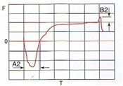 Fig.2 Weltting Curve2 Sn-3.5Ag 240
